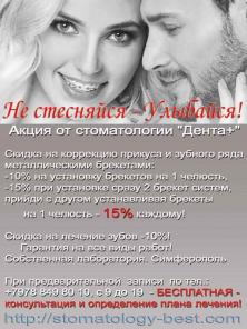 Сертифицированные импланты системы Нобель по доступным ценам от производителя!